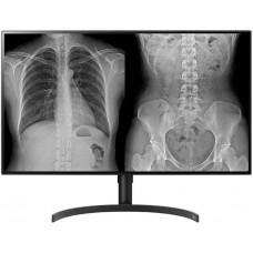 LG 32HL512D-B 8 MP-es diagnosztikai monitor